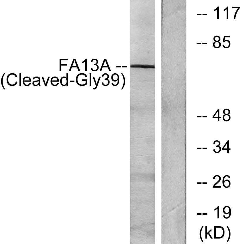 Cleaved Factor XIIIa G39 Polyclonal Antibody ELISA Cleaved factor xiiia g39 polyclonal antibody elisa