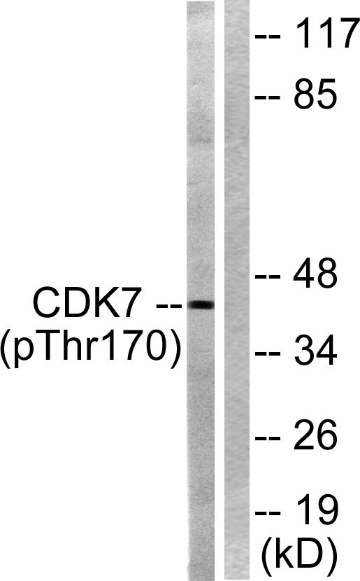 Cdk7 (phospho Thr170) Polyclonal Antibody- ELISA科研检测中心-优品生物官网