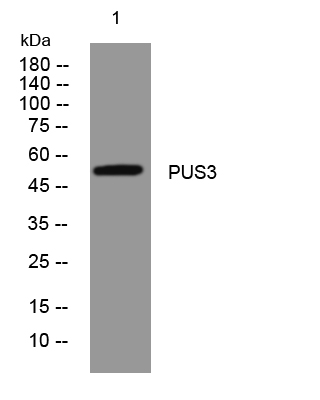 Pus3 Mutation PUS3 mouse mAb- ELISA科研检测中心-优品生物官网
