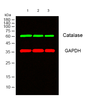 catalase 基本信息 | sino biological Images High... Catalase Monoclonal Antibody- ELISA科研检测中心-优品生物官网