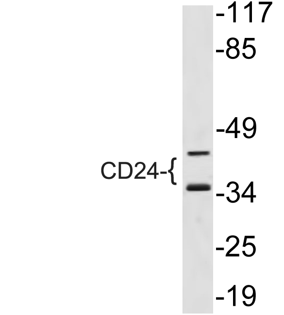 CD24 Monoclonal Antibody- ELISA科研检测中心-优品生物官网