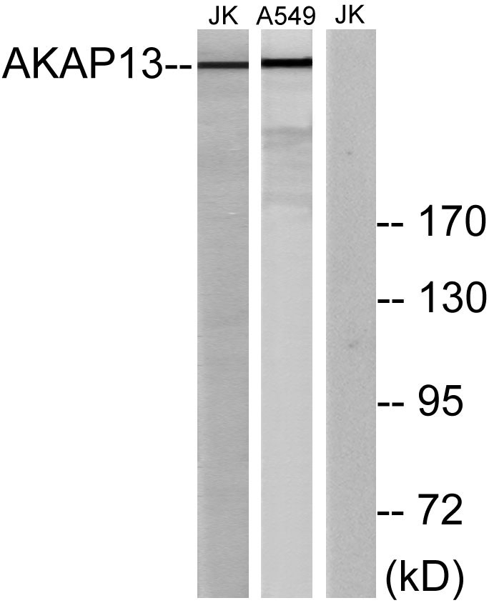 AKAP 13 Monoclonal Antibody- ELISA科研检测中心-优品生物官网