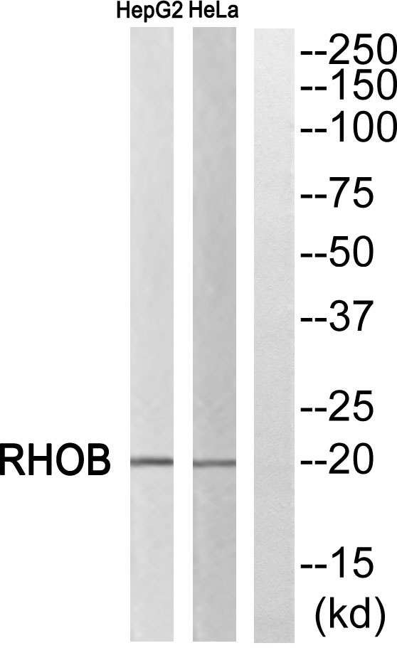 Rho B Monoclonal Antibody- ELISA科研检测中心-优品生物官网
